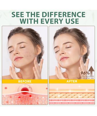 WHLH & WELL-BEING Beef Tallow for Skin Beef Tallow and Honey Balm All-Natural Ingredient Moisturizer for Face & Body Skin Care 1Pack - Buy Online on GoSupps.com