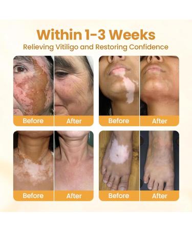 Foot Cream - Care Lotion | Nourishing and Illuminating Plant Extracts to Moisturize Dry Sensitive Skin on the Body and Hands - Buy Online on GoSupps.com