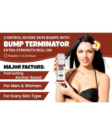 Buy BUMP Terminator Extra Strength - Fast Acting Alcohol-Based Anti Razor Bumps & Ingrown Hair Treatment for Men & Women - Buy Online on GoSupps.com