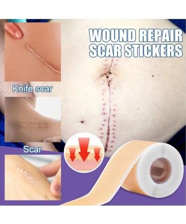 Breathable Reusable Silicone Scar Sheet Roll - Soften Old & New Scars for Surgery & Acne - Buy Online on GoSupps.com