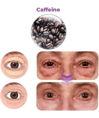 Milk spots soothe electric serum pen Eye cream Electric serum Electric serum pen Moisturizing Anti-aging cream to reduce milk spots and sagging eyes - Buy Online on GoSupps.com