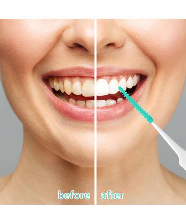 220-Piece Green Silicone Interdental Brushes for Braces - Oral Cleaning Floss Picks - Buy Online on GoSupps.com