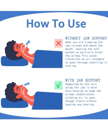 Advanced Adjustable Anti-Snoring Chin Strap for Snore Reduction - Breathable & Comfortable - Buy Online on GoSupps.com