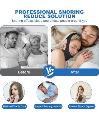 Adjustable Anti-Snoring Chin Strap for CAPA Users with 60 pcs Mouth Tape - Pink - Buy Online on GoSupps.com
