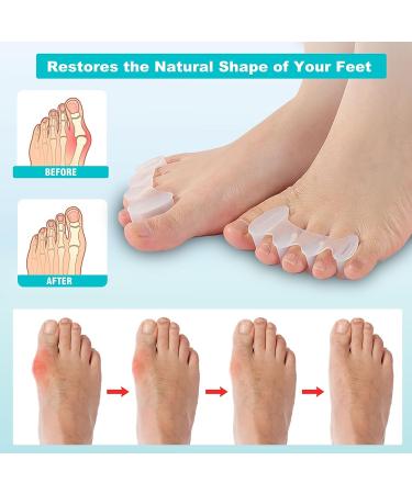 KAIDILA Toe Separators - Bunion Corrector Toe Spacers for Women/Men | Toe Corrector for Bunions, Hammertoes, Hallux Valgus | 1 Pair Medium Size White - Buy Online on GoSupps.com