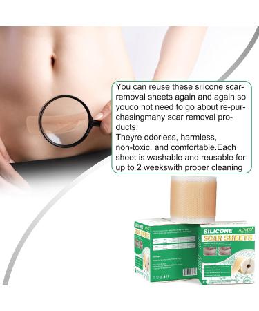 Silicone Scar Sheets Medical Grade Silicone Scar Tape Silicone Scar Strips for Scar Healing Painless Scar Removal Tape for All Surgical Incisions C-Section Burn Keloid Acne (1.6x60inch-1.5M) - Buy Online on GoSupps.com