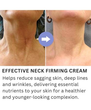 Tighten And Lift Neck Cream Pure Neck Firming Cream Tightening Lifting Sagging Skin Go Anti-Aging Neck Cream Anti-Wrinkles Neck Cream for an Even Skin Tone and Neck Lift (3PCS) - Buy Online on GoSupps.com