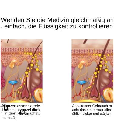 Hair oil oil applicator for hair oil hair oil dispenser liquid applicator for men and women - Buy Online on GoSupps.com