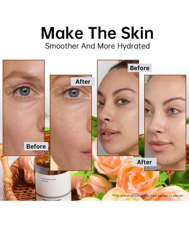 Retinol 1% in Squalane Serum For Face 30ML Moisturizing Retinol Face Serum For Fine Lines & Acne Retinol Serum For Dry Skin. - Buy Online on GoSupps.com