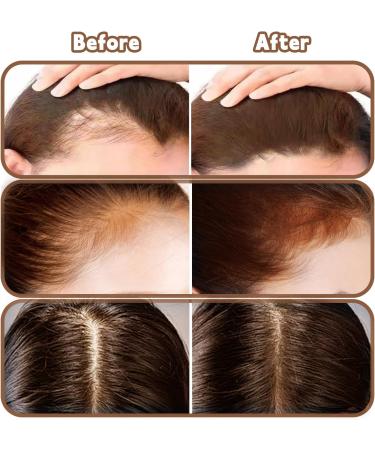 Retouche Racines Cheveux Marron Moyen Poudre Cheveux Waterproof Poudre Racine Femme et Homme Blanc Gris Longue Tenue et Naturelle-2g/0.07oz - Buy Online on GoSupps.com