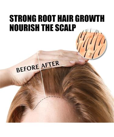 Pumpkin Seed Oil for Hair Growth 100% Organic Pumpkin Seed Oil for Hair Organic Pumpkin Seed Oil for Hair Growth Cold Pressed Aromatherapy Massage Oil Repair of Damaged Hair (3 Pieces) 3pc - Buy Online on GoSupps.com