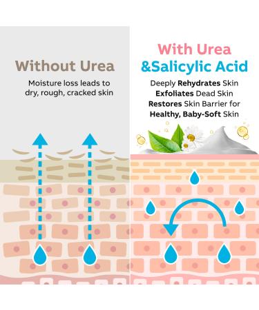 Adellina Urea Cream 40% for Dry Cracked Heels - Callus Remover with Salicylic Acid, Tea Tree Oil, Shea Butter - Foot and Body Cream 5.3 Oz - Buy Online on GoSupps.com