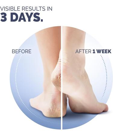 Scholl Cracked Heel Repair Cream 60ml - Effective Treatment for Dry and Cracked Heels - Buy Online on GoSupps.com