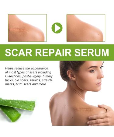 Goopgen Medical Grade Scar Repair Serum - Advanced Proregen Formula for All Types of Scars - Buy Online on GoSupps.com
