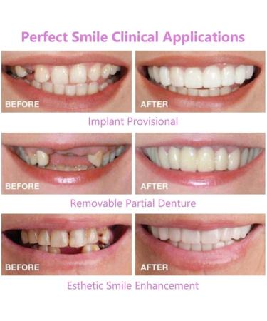 2 Pairs Nature and Comfortable Top and Bottom Adjustable for Men and Women Beautiful Smile - Buy Online on GoSupps.com