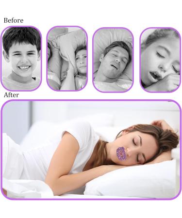 60 Pcs Mouth Tape for Sleeping | Stop Snoring & Mouth Breathing | Improve Nose Breathing | Sleep Strips for Adults (laage-1) - Buy Online on GoSupps.com