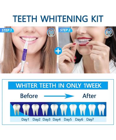 Xumann 28PCS 9D Teeth Whitening Strips & 3PCS Whitening Pen Combo - Professional 5D 3D Upgraded Dental Whitener Kit - Buy Online on GoSupps.com