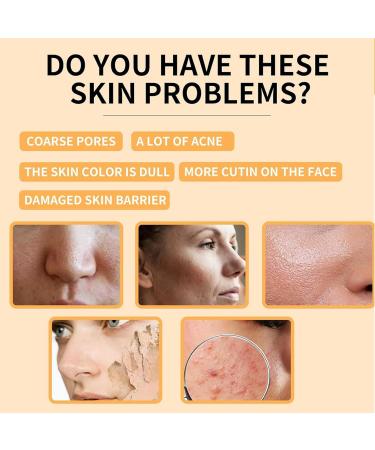 Glycolic Acid 7% Toning Resurfacing Solution Hydrating Toning Solution Skincare Hyaluronic Acid Serum Exfoliate Brighten Blemishes Acne and Rejuvenate Moisturize & Strengthen Your Skin 240ml - Buy Online on GoSupps.com