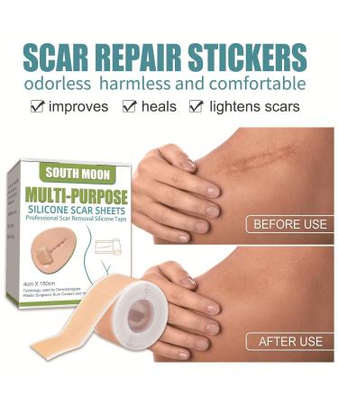 Medical Grade Silicone Scar Sheets - C-Section Surgery Burn Keloid & Acne Treatment | 1.6 x 60 Roll - Buy Online on GoSupps.com