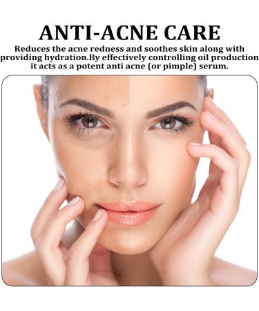 AHA 30% + BHA2% Peeling Solution Exfoliating Facial Serum for Hydrated Serum for Face Peeling Solution Reduces Pore Congestion and Fine Lines Smooth Skin Skincare Tightening Cream for Face - Buy Online on GoSupps.com