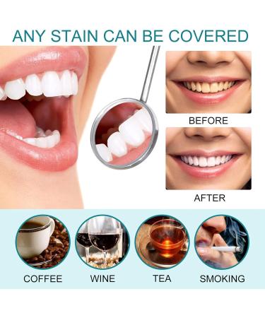 Uptight White Instant Whitening Tooth Paint for Stain Removal - 1PCS - Buy Online on GoSupps.com
