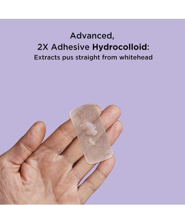 Avarelle Pimple Patches (16 Count) Hydrocolloid Acne Cover with Tea Tree & Calendula - Vegan & Cruelty-Free | Zit & Blemish Treatment - Buy Online on GoSupps.com