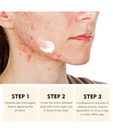Acne Treatment for Face for Hormonal Cystic Stubborn Acne Cream for Sensitive Skin Teens Adults Women Collagen Face Mask Bio-Collagen Hydrating Face Mask 30g x 4ea - Buy Online on GoSupps.com