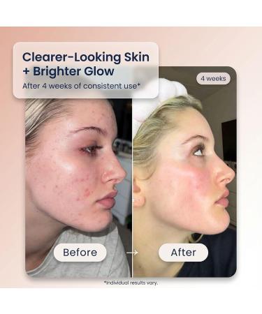 Bohemia Skin Kay's Glow Serum - Vitamin C Serum for Face (THD Ascorbate) - Hydrating Dark Spot & Post Blemish Mark Fader - Oxygen Infused for Radiant Dewy Skin - Non Sticky & Non Comedogenic - 1 Fl Oz - Buy Online on GoSupps.com