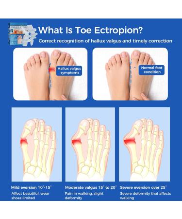 Rechargeable Face Cleansing Brush + Bunion Guard & Corrector Set for Pressure Relief - Gel Toe Splitter & Protector for Bent Toes - Amazing Beauty - Buy Online on GoSupps.com