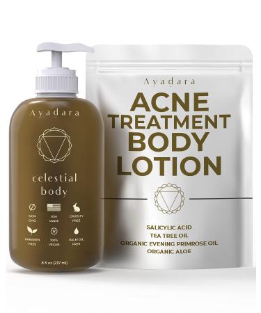 Ayadara Anti-Acne Treatment Body Lotion | Pimple Cream with Salicylic Acid  Tea Tree  & Aloe Vera | Chest  Arm  Shoulder  Thigh  Butt  & Back Acne Treatment for Women  Men  & Teens | 75-Day Supply