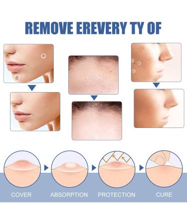Skin T-ag Remover Patches Mole Wart Removing Sticker Natural Ingredients 144PCS QINQUAN - Buy Online on GoSupps.com