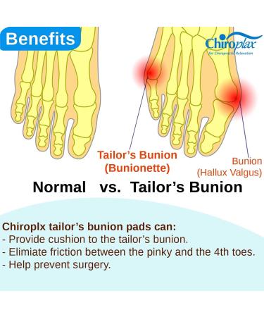 Chiroplax Tailor's Bunion Corrector Pads - Pain Relief Toe Separator Cushion (4 Pack) - Buy Online on GoSupps.com