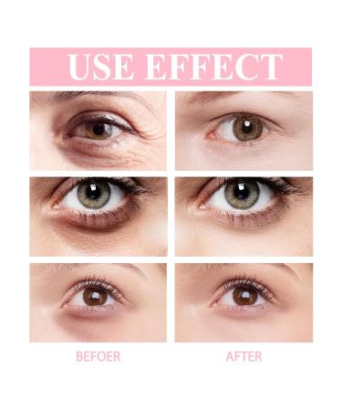 Retinol Eye Cream Stick Moisturizes and Improves Fine Lines Crow's Feet Dark Circles and Tightens Eye Skin - Buy Online on GoSupps.com