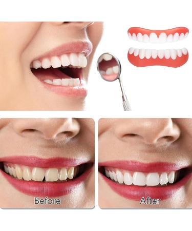 Wttfc snapon dentures Veneers Clickin veneers dentures Instant veneers Clipin veneers cosmetic teeth whitening for men and women regain a confident smile - Buy Online on GoSupps.com