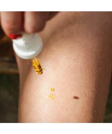 Loelle - 100% Pure Rosehip Oil for Face with High Vitamin E Content - Regenerating Remedy Against Eczema and Scars - Anti-Wrinkle Moisturiser - Harvested in Chile (30ml) - Buy Online on GoSupps.com