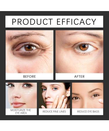  Orgrul Harveyross Instant Lift Plus Dark Circles Harveyross Instant Iift Plus Dark Circles Harveyross Under Eye Bags Instant Lift Instant Removal Bags Dark Circles Closing Skin (2 Pack 50 ml) - Buy Online on GoSupps.com