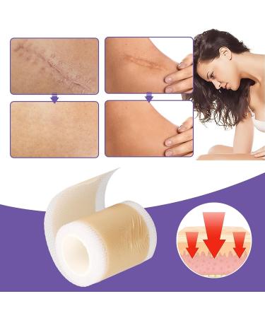 Breathable Reusable Silicone Scar Sheet Roll - Soften Old & New Scars for Surgery & Acne - Buy Online on GoSupps.com