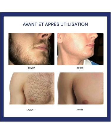 Depilatory Body Cream - 60 ml Effective Painless Soothing Depilatory Gel Hair Removal for Sensitive Skin Types Arms Legs Back Torso Intimate Area - Buy Online on GoSupps.com