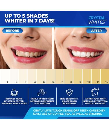 Teeth Whitening Kit + Blue Light Whitening | X8 Gels & 5 Professional Whitening Strips - 45+ Whitening Sessions - Safe for Teeth & Gums with - Buy Online on GoSupps.com