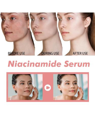 30ml 70% Peach Niacinamide Serum Face Serum for Women Anti-Aging Face Serum with Peach Essence Collagen Serum for Face Daily Clean Beauty Skincare Brightening Hydrating Face Glow Serum Skinserum - Buy Online on GoSupps.com