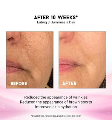 Joyce Giraud Ultimate Beauty Gummies 90-Day Supply Supports Skin Hydration & Healthy Skin Tone 270 Gummies 90-Day Supply (270 Gummies) - Buy Online on GoSupps.com