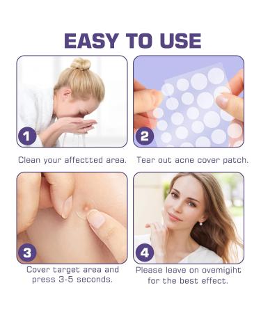Mandabloom Acne Pimple Patches (210 Pack) with Tea Tree Oil & Salicylic Acid - Hydrocolloid Acne Dots for Face Zits & Breakouts - Buy Online on GoSupps.com