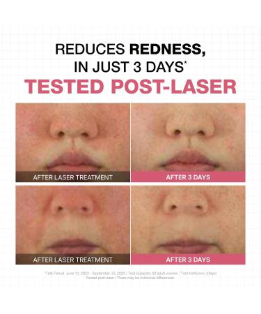 Physiogel Calming Relief Cream Face and Body Lotion Reduces Redness in just 3 days Sensitive Skin Korean skin care Fragrance-Free Non-Comedogenic Dermatologist-Tested. - Buy Online on GoSupps.com