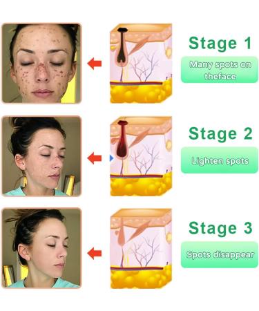 Gel Exfolant Purifiant | Nettoyant Exfolant Pour Le Visage | Gel Exfoliant Doux Pour Le Visage | 50 G De Profondeur Purification Du Corps R parez Les Rougeurs R tr cissement Des Pores gayant La - Buy Online on GoSupps.com