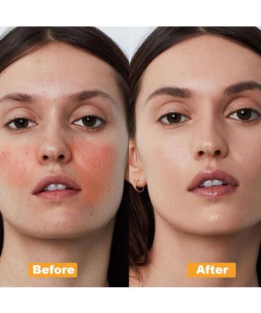 Snail Mucin Cream 3.52 fl oz | Collagen Lifting & Firming Cream for Youthful Skin | International Shipping Available - Buy Online on GoSupps.com