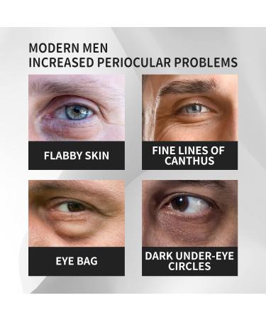 OLLZPJFPK Men's Eye Cream Lighten Eye Bags Dark Circles Fine Lines Firming Skin Moisturizing Eye Cream - Buy Online on GoSupps.com