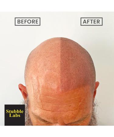 Stubble Labs Waterproof Hairline Cover Up | Best Bald Spot Hair Filler for Men & Women - Superior to Hair Fibers - Buy Online on GoSupps.com