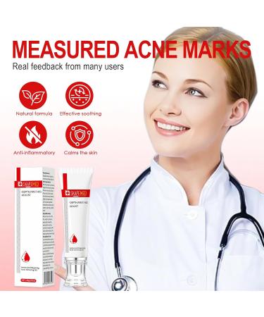 Tpubmity 25 g antiacne face cream acne removing gel antipimples immediate relief instantly cools and soothes reduces redness blue 25 g - Buy Online on GoSupps.com