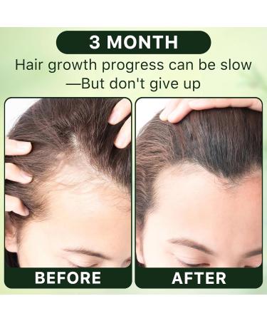 Organic Rosemary Oil for Hair Growth - 100% Pure & Natural Cold Pressed 8 Fl Oz - Strengthening Hair Treatment with Jojoba & Castor Oil - Buy Online on GoSupps.com