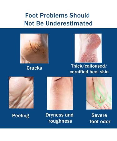 Urea Foot Cream 40 Percent - Cracked Heel Repair Cream For Feet and Hand - Athletes Foot Cream for Very Dry Feet - Foot Moisturiser - Foot Care Cream - Skin Care Cream for Hand Foot and Body 85g - Buy Online on GoSupps.com